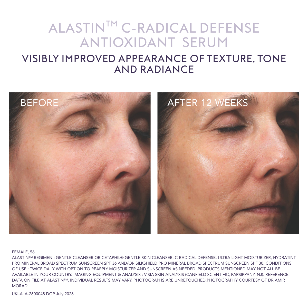 Alastin C-Radical Defense Antioxidant Serum