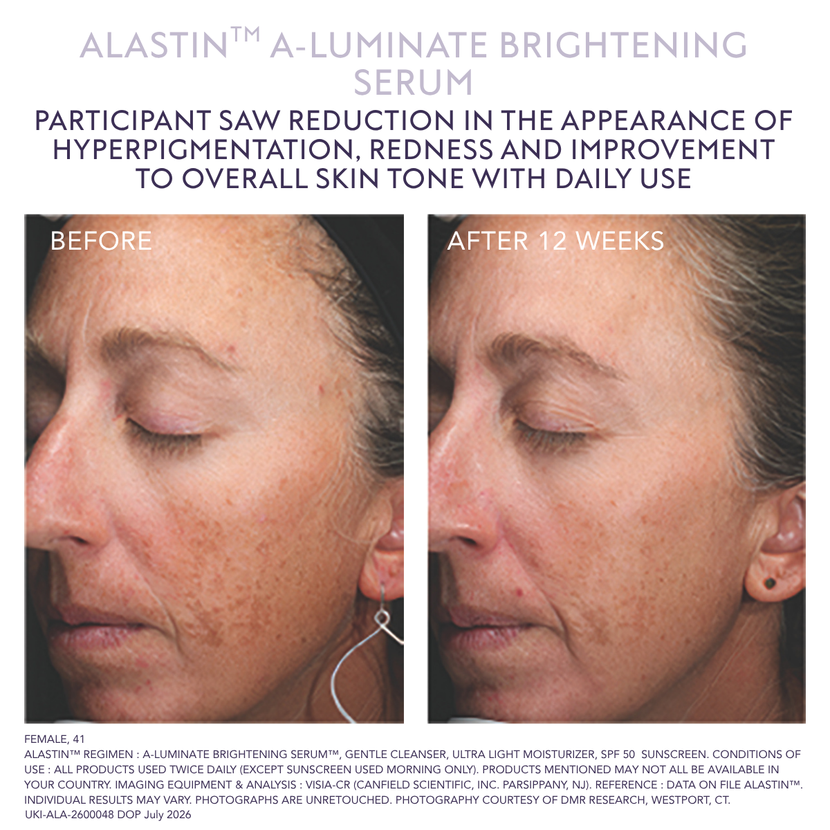 Alastin A-Luminate serum