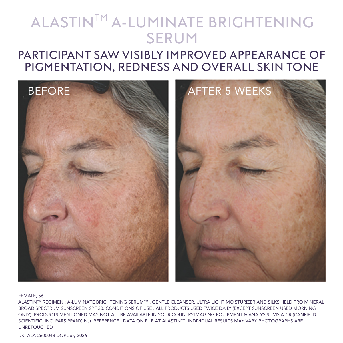 Alastin A-Luminate serum