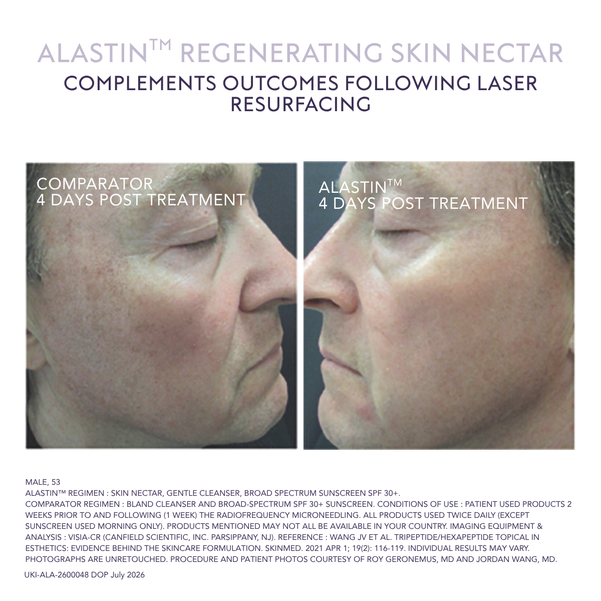 Alastin Regenerating Skin Nectar Face Serum