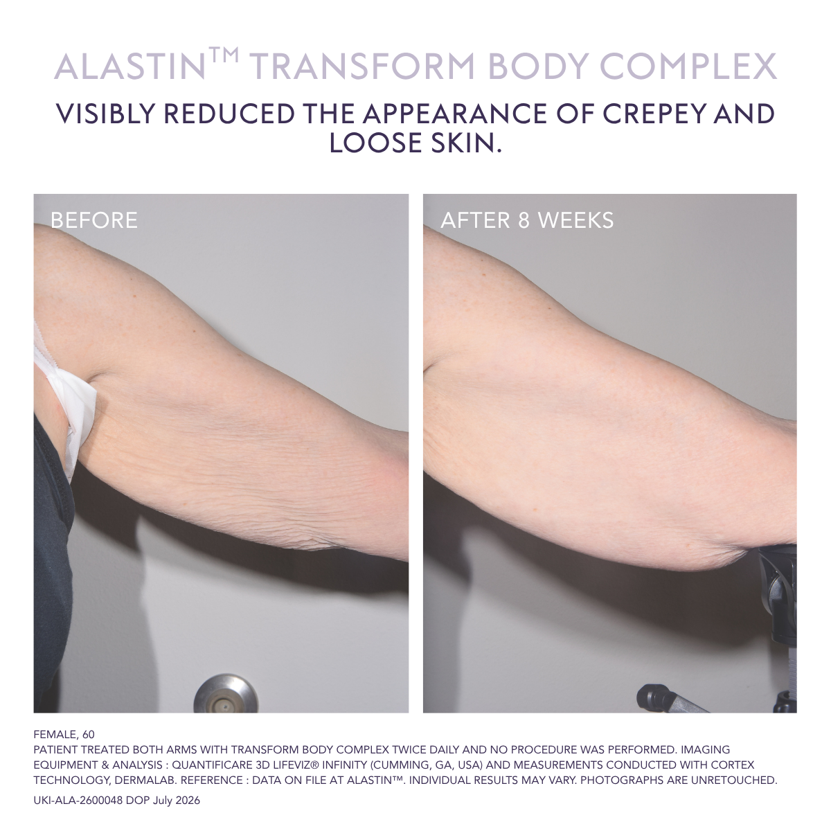 Alastin TransFORM Body Complex